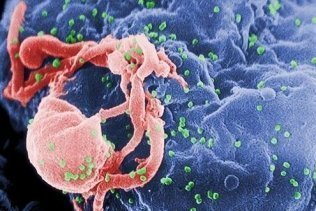 Un equipo médico afirma haber curado a un bebé con VIH