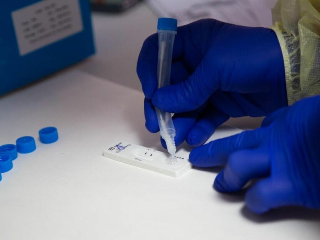 Andalucía confirma un cuarto caso de cepa Ómicron